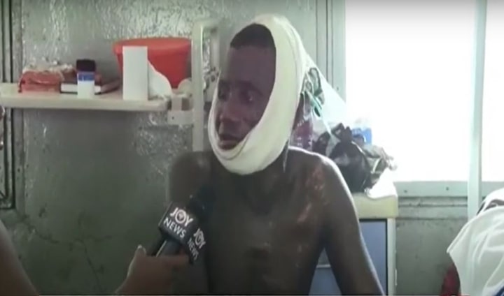 Ghana: Man who lost his hand when suspected dynamite meant for fishing exploded